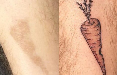  Top  10+ tatuaje care pot transforma cicatricele in adevarate opere de arta