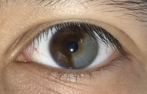  Top  10+ defecte genetice care demonstreaza ca frumusetea nu inseamna perfectiune