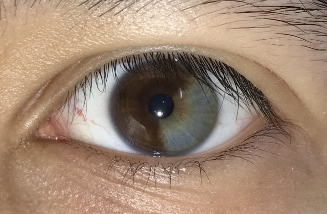 10+ defecte genetice care demonstreaza ca frumusetea nu inseamna perfectiune