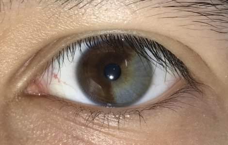  Top  10+ defecte genetice care demonstreaza ca frumusetea nu inseamna perfectiune