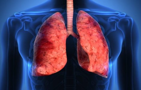 Ministrul Sanatatii spune ca ar putea fi adus in Romania un medicament impotriva cancerului pulmonar
