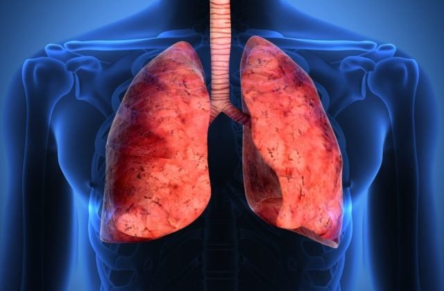 Ministrul Sanatatii spune ca ar putea fi adus in Romania un medicament impotriva cancerului pulmonar