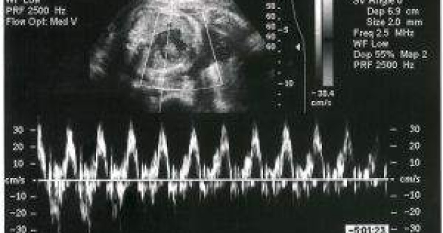 MS: Nimeni nu poate interzice unei femei sa faca avort