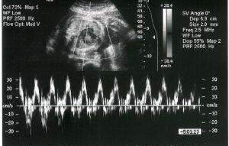 MS: Nimeni nu poate interzice unei femei sa faca avort