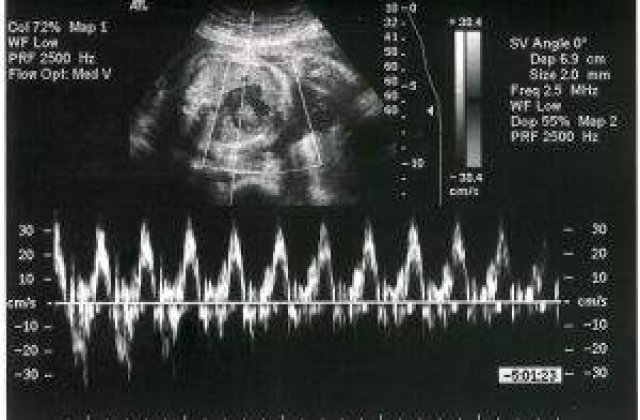 MS: Nimeni nu poate interzice unei femei sa faca avort