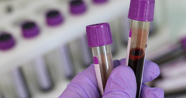 O noua analiza de sange poate detecta pana la 90% dintre cazurile de endometrioza