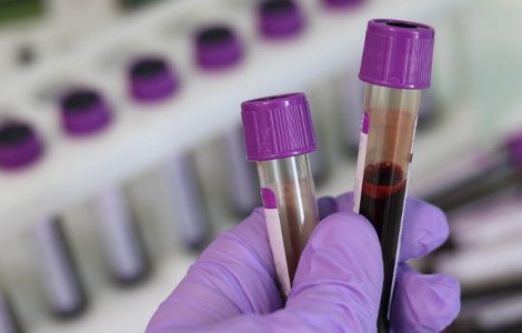 O noua analiza de sange poate detecta pana la 90% dintre cazurile de endometrioza