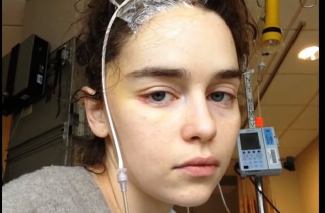 Actrita Emilia Clarke a facut publice imagini cu ea din spital, dupa primul anevrismul cerebral