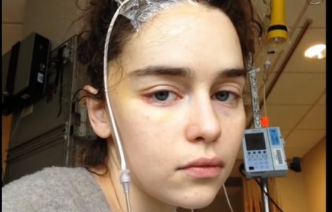 Emilia Clarke a aratat poze cu ea pe patul de spital