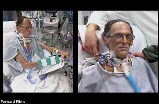 [VIDEO] Cine este primul om care traieste fara INIMA?