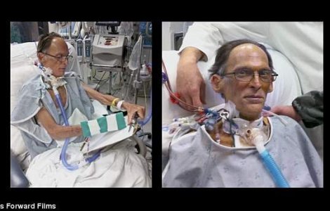  Video  Cine este primul om care traieste fara INIMA?