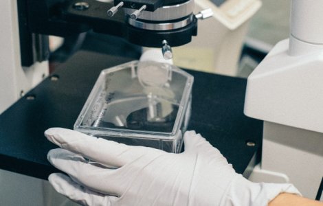 Peste 100 de gene asociate cu un risc ridicat de schizofrenie, identificate de cercetatori