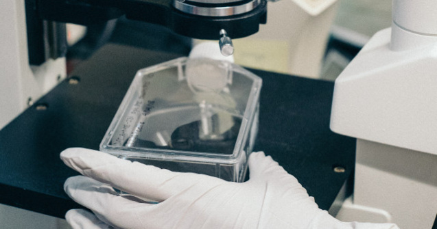 Peste 100 de gene asociate cu un risc ridicat de schizofrenie, identificate de cercetatori