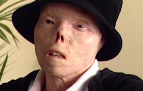 A murit Jacqui Saburido, femeia a carei fata desfigurata a devenit simbolul riscurilor la care ne expune condusul sub influenta alcoolului