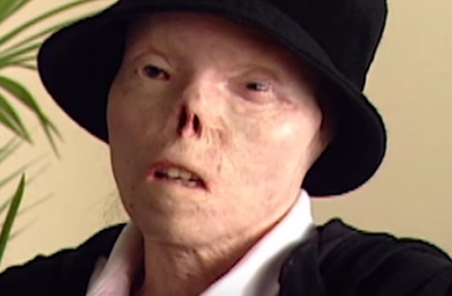 A murit Jacqui Saburido, femeia a carei fata desfigurata a devenit simbolul riscurilor la care ne expune condusul sub influenta alcoolului