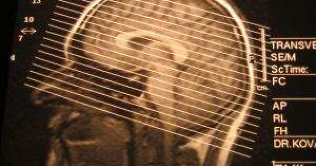 Actorul Iurie Darie ar putea fi operat zilele urmatoare