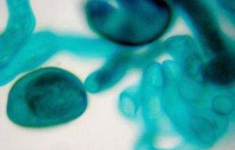 34 de cazuri de borelioza in 2012, in scadere fata de 2011