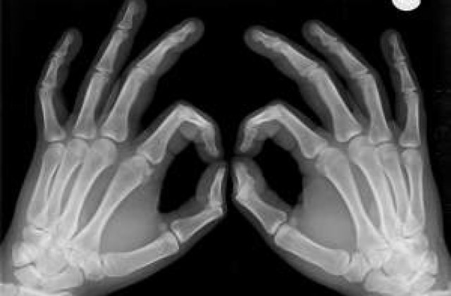 O noua metoda de detectare a osteoporozei, de la astronauti