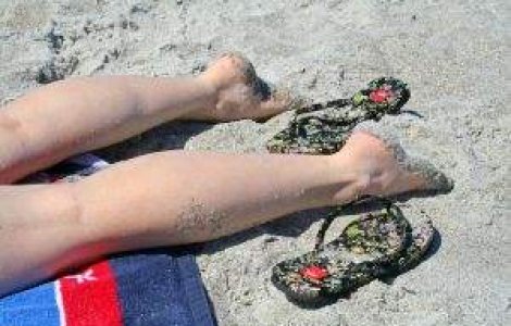 Solutii rapide si simple pentru tratarea arsurilor de soare