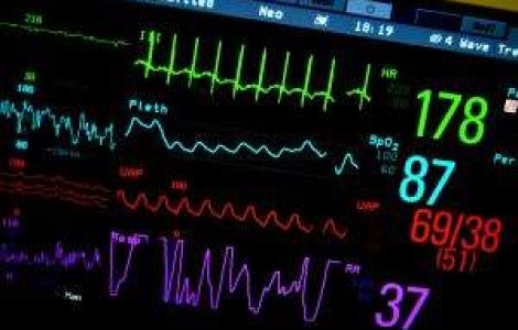 CMR: Sistemul retetei electronice ar trebui implementat in 2013