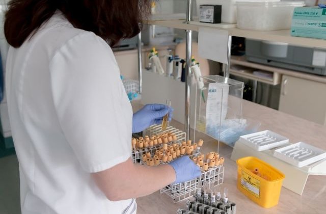 O echipa de cercetatori a reusit eliminarea virusului HIV la soareci infectati