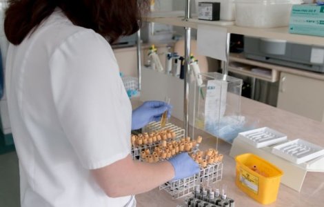 O echipa de cercetatori a reusit eliminarea virusului HIV la soareci infectati