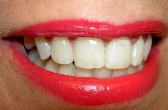 Gata cu vizitele la dentist: S-a inventat molecula "anti-carii"