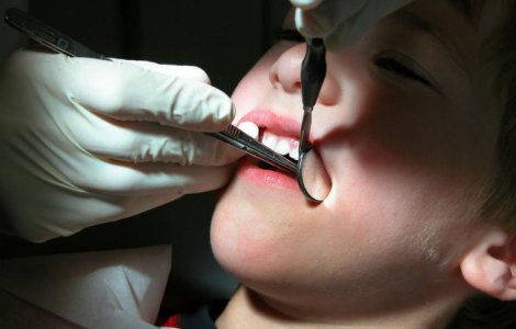 ASSMB ofera vouchere de pana la 990 de lei pentru aparate ortodontice destinate copiilor