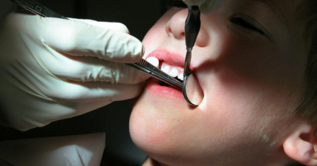 ASSMB ofera vouchere de pana la 990 de lei pentru aparate ortodontice destinate copiilor