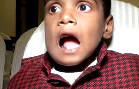 Unui baietel din India i s-au indepartat peste 500 de dinti din gura