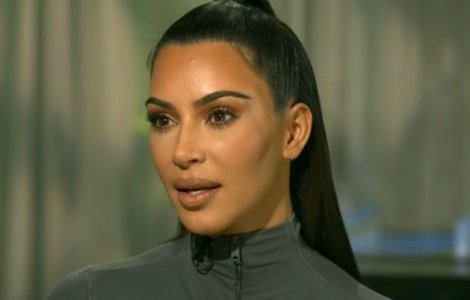 Kim Kardashian ar putea avea lupus