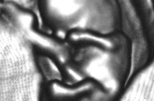 Orasul blestemat: 18 copii s-au nascut cu aceleasi malformatii la maini si picioare