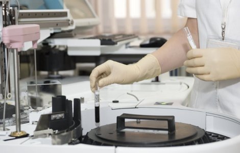 Cum preintampini infectiile urinare