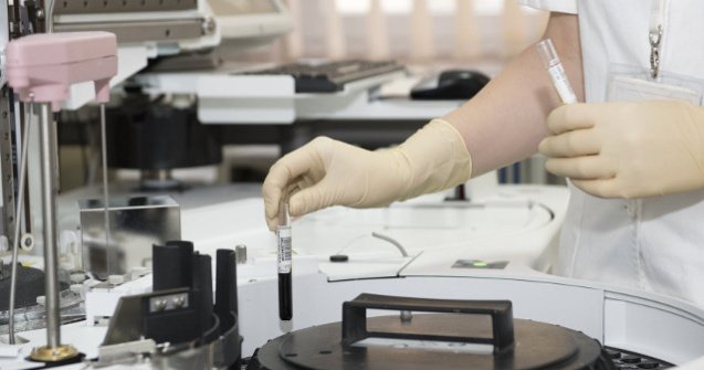 Cum preintampini infectiile urinare