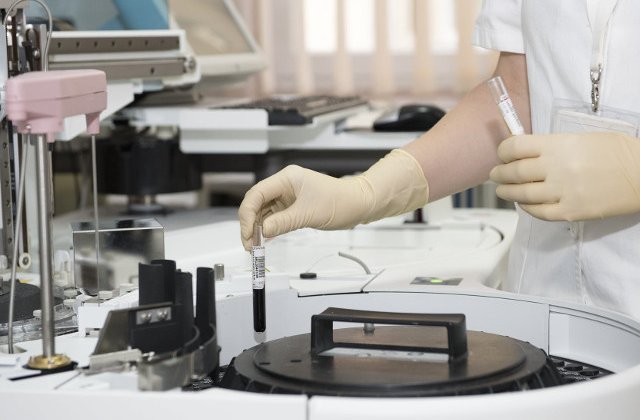 Cum preintampini infectiile urinare