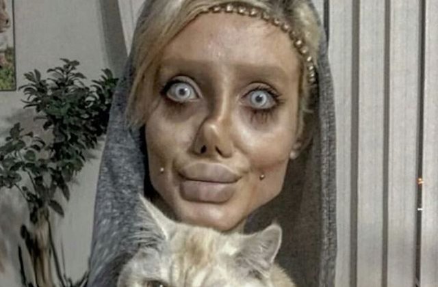 Cum arata inainte de cele 50 de operatii estetice tanara care a vrut sa semene cu Angelina Jolie /VIDEO