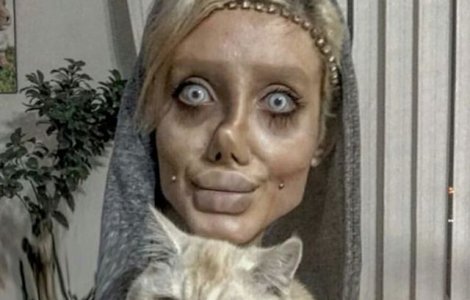 Cum arata inainte de cele 50 de operatii estetice tanara care a vrut sa semene cu Angelina Jolie /VIDEO