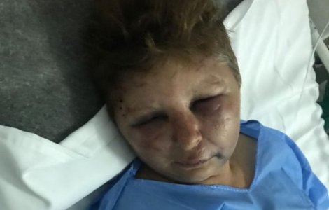 Femeia agresata de politistul din Olt: "A inceput sa strige ca de la el din casa nu mai scap, decat cu picioarele inainte"