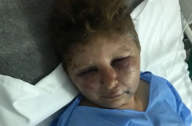 Femeia agresata de politistul din Olt: "A inceput sa strige ca de la el din casa nu mai scap, decat cu picioarele inainte"