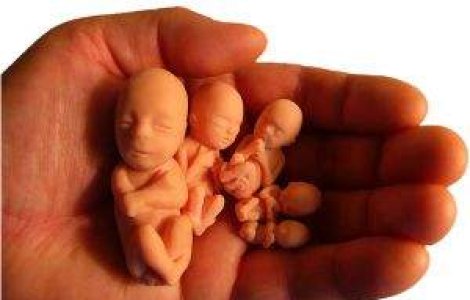 Adevarul tragic despre Romania: Pana la 400 de intreruperi de sarcina in fiecare zi