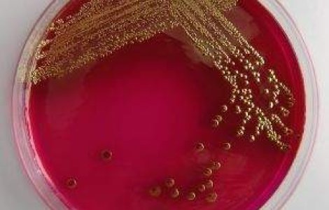 Transplantul de materie fecala a salvat viata unei femei