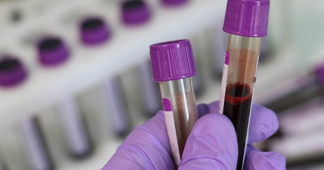 Un test de sange ar putea detecta cancerul mamar cu cinci ani inainte de aparitia simptomelor