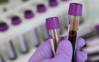 Un test de sange ar putea...