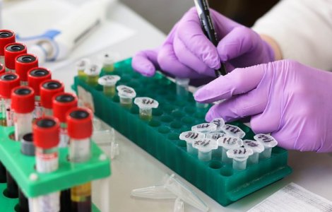 Studiu: A fost identificata o noua tulpina a virusului HIV