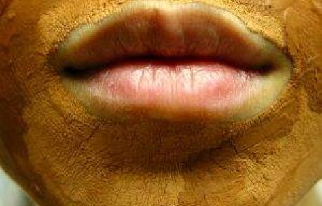 Cele mai dezgustatoare tratamente faciale