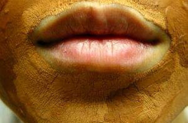 Cele mai dezgustatoare tratamente faciale