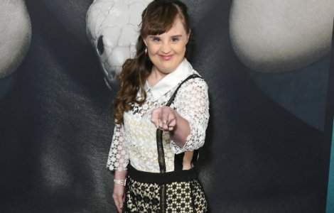  Top  Au daramat toate barierele: 10 persoane cu sindrom Down care au facut performanta