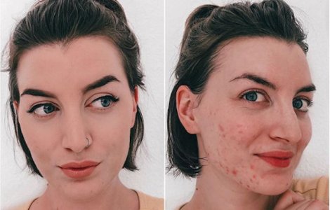  Top  10+ fotografii ce dezvaluie adevarurile din spatele "vietii perfecte" de pe social media