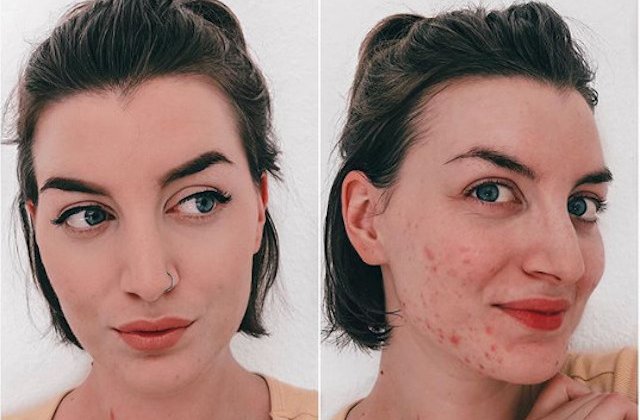 10+ fotografii ce dezvaluie adevarurile din spatele "vietii perfecte" de pe social media