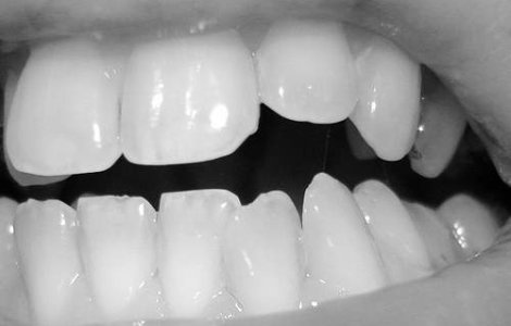 Arestat pentru o vizita gol-pusca la dentist